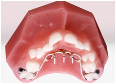 Defay Orthodontics teeth